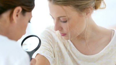 Penyebab Kista Sebaceous, Pengobatan Rumahan dan Tips Pencegahan