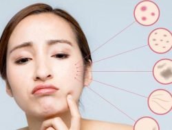 Minuman Collagen Terbaik Roove Kembalikan Elastisitas Kulit Sekaligus Pelihara Kesehatan Jantung