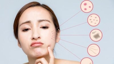 Minuman Collagen Terbaik Roove Kembalikan Elastisitas Kulit Sekaligus Pelihara Kesehatan Jantung