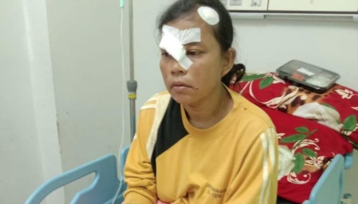 Petugas Kebersihan di Pantai Pangandaran Alami Luka Serius Akibat Tertabrak ATV