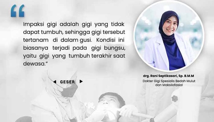 Impaksi Gigi: Tantangan Kesehatan Oral yang Perlu Diketahui