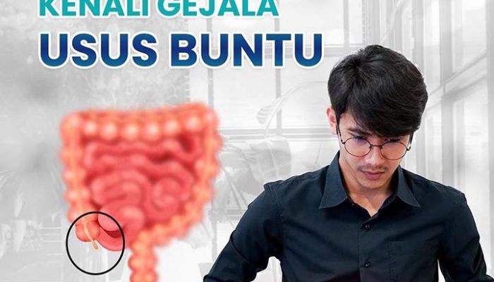 Pentingnya Pemahaman untuk Mencegah Komplikasi dari Usus Buntu